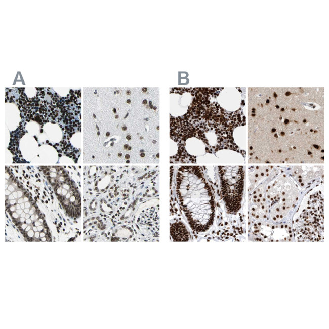 BCLAF1 Antibody in Immunohistochemistry (IHC)