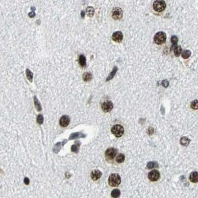 BCLAF1 Antibody in Immunohistochemistry (IHC)