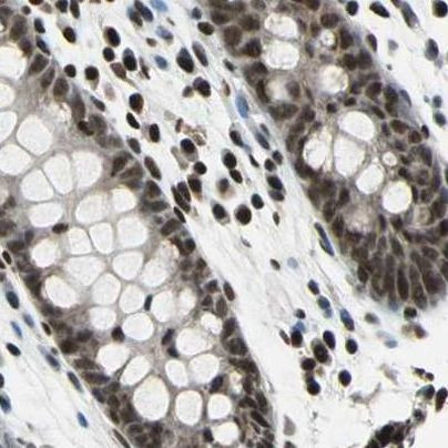 BCLAF1 Antibody in Immunohistochemistry (IHC)