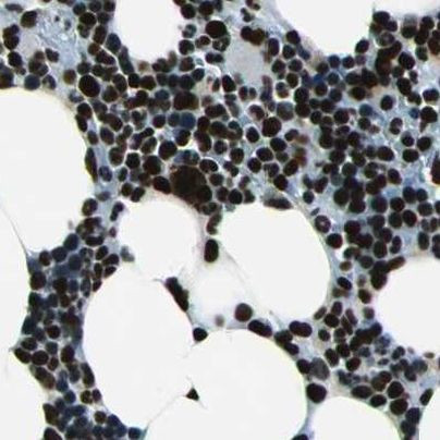 BCLAF1 Antibody in Immunohistochemistry (IHC)