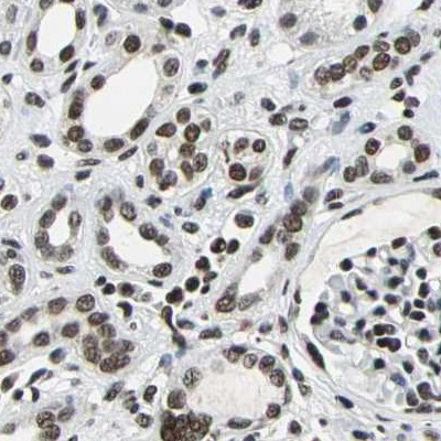 BCLAF1 Antibody in Immunohistochemistry (IHC)