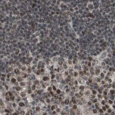 ZHX2 Antibody in Immunohistochemistry (IHC)