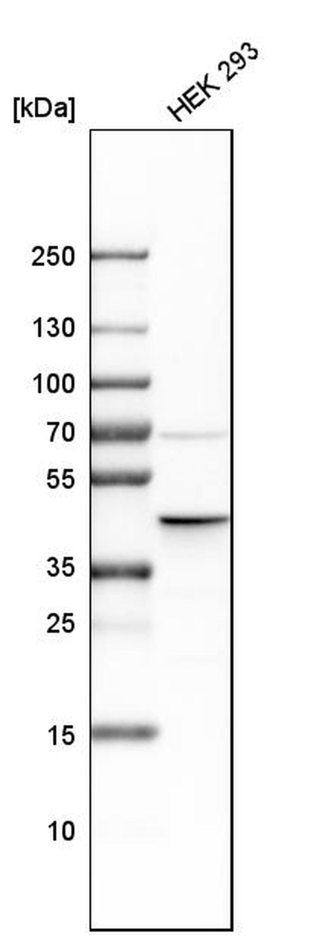 ILF2 Antibody in Western Blot (WB)