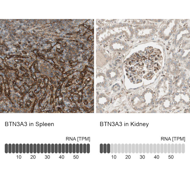 BTN3A3 Antibody in Immunohistochemistry (IHC)