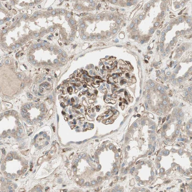 BTN3A3 Antibody in Immunohistochemistry (IHC)