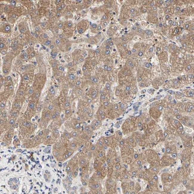 TSKU Antibody in Immunohistochemistry (IHC)