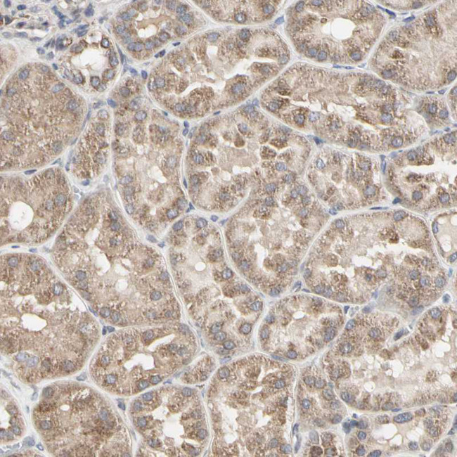 TSKU Antibody in Immunohistochemistry (IHC)