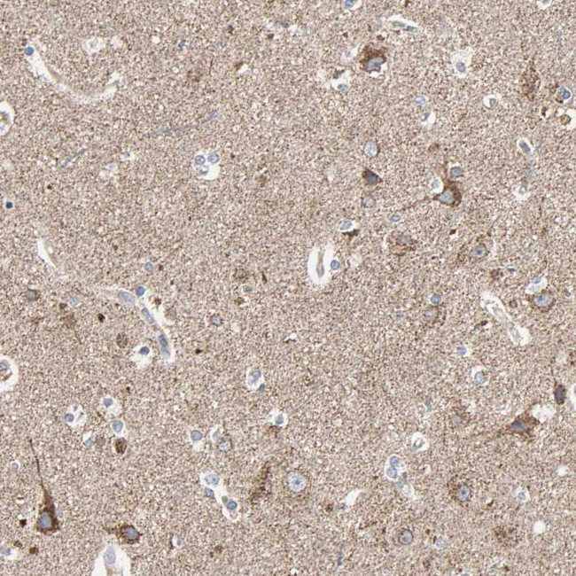 TSKU Antibody in Immunohistochemistry (IHC)