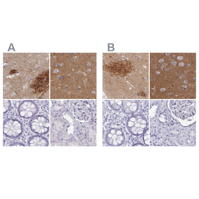 OMG Antibody in Immunohistochemistry (IHC)