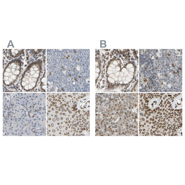 UNC84A Antibody in Immunohistochemistry (IHC)