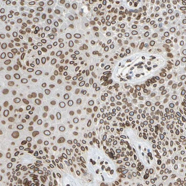 UNC84A Antibody in Immunohistochemistry (IHC)