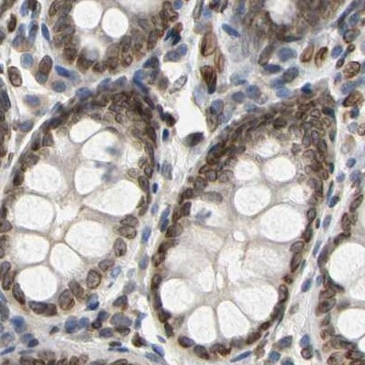 UNC84A Antibody in Immunohistochemistry (IHC)