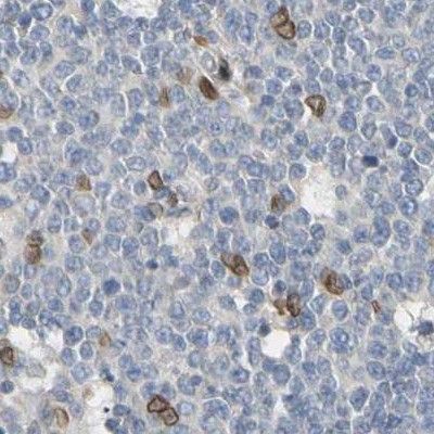 UNC84A Antibody in Immunohistochemistry (IHC)