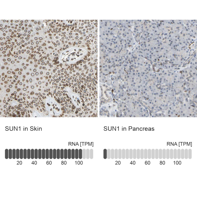 UNC84A Antibody