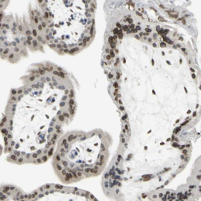 UNC84A Antibody in Immunohistochemistry (IHC)