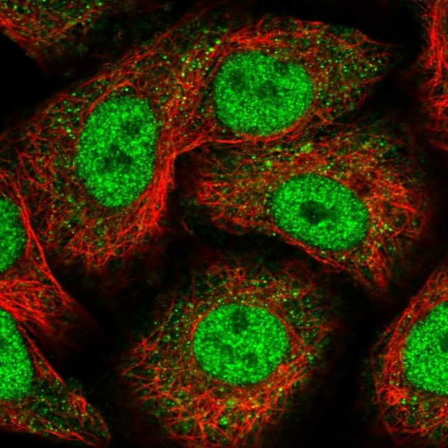 Nope Antibody in Immunocytochemistry (ICC/IF)