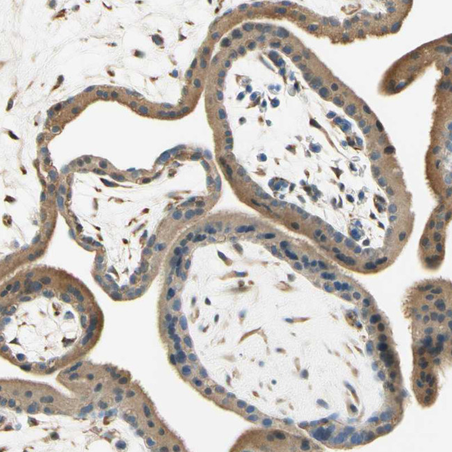 Nope Antibody in Immunohistochemistry (IHC)