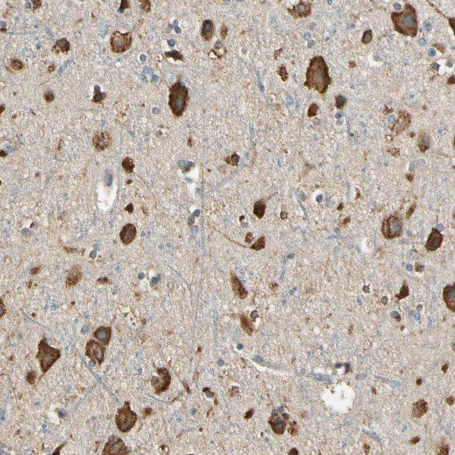 Nope Antibody in Immunohistochemistry (IHC)