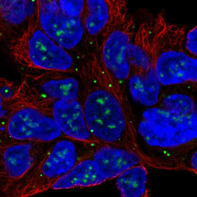 SLC6A15 Antibody in Immunocytochemistry (ICC/IF)