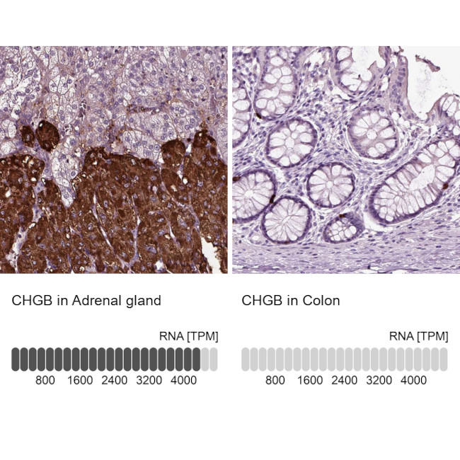 Chromogranin B Antibody in Immunohistochemistry (IHC)