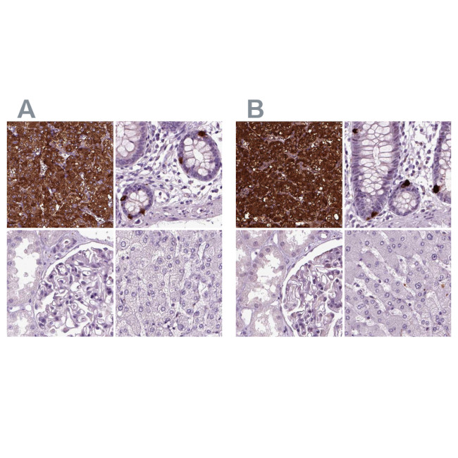 Chromogranin B Antibody in Immunohistochemistry (IHC)