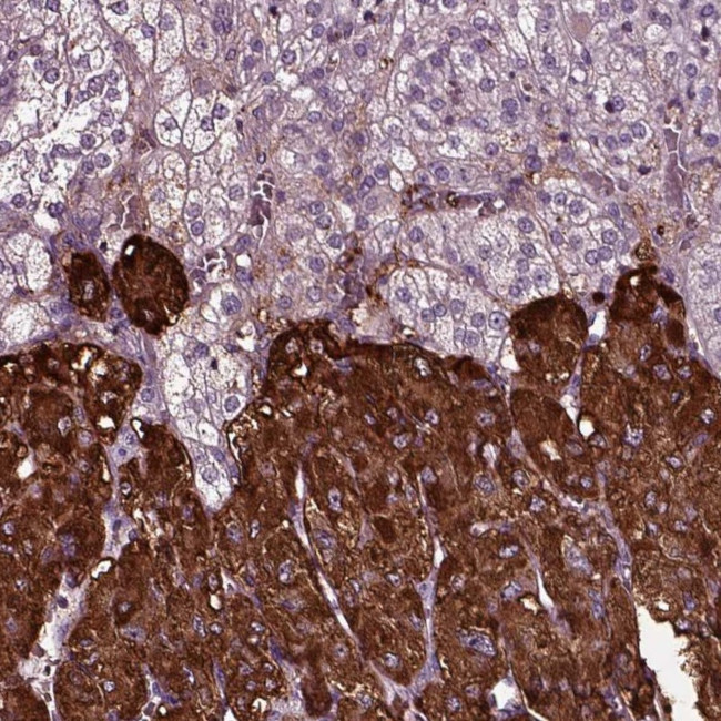 Chromogranin B Antibody in Immunohistochemistry (IHC)