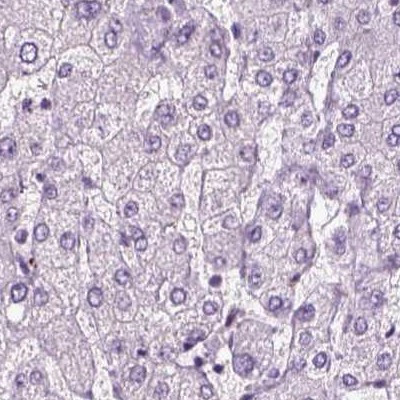 Chromogranin B Antibody in Immunohistochemistry (IHC)