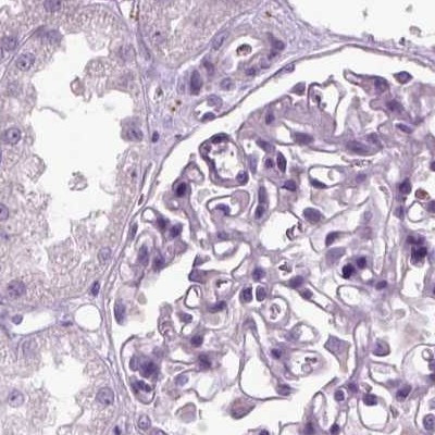 Chromogranin B Antibody in Immunohistochemistry (IHC)