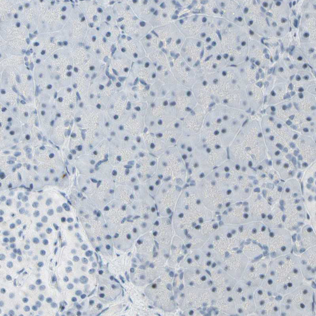 B4GALNT1 Antibody in Immunohistochemistry (Paraffin) (IHC (P))