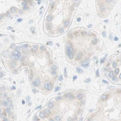 MANEA Antibody in Immunohistochemistry (IHC)