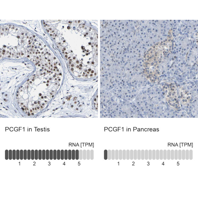 PCGF1 Antibody in Immunohistochemistry (IHC)