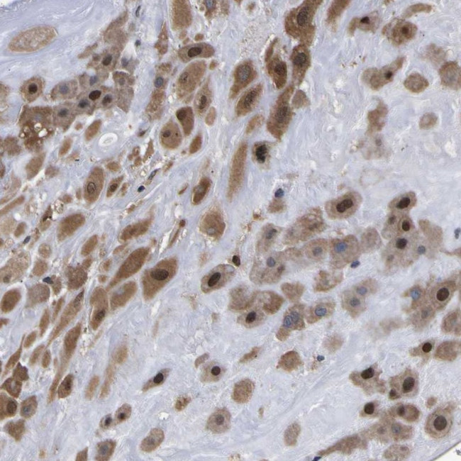 FAM110B Antibody in Immunohistochemistry (IHC)