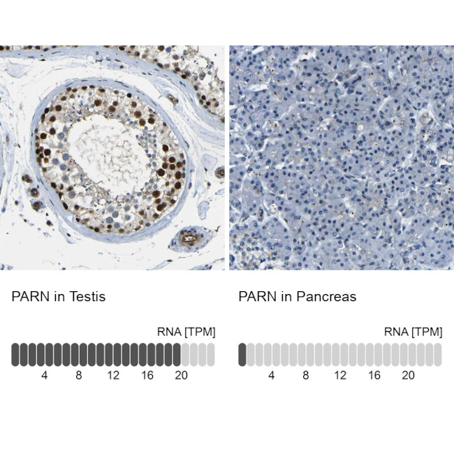 PARN Antibody in Immunohistochemistry (IHC)