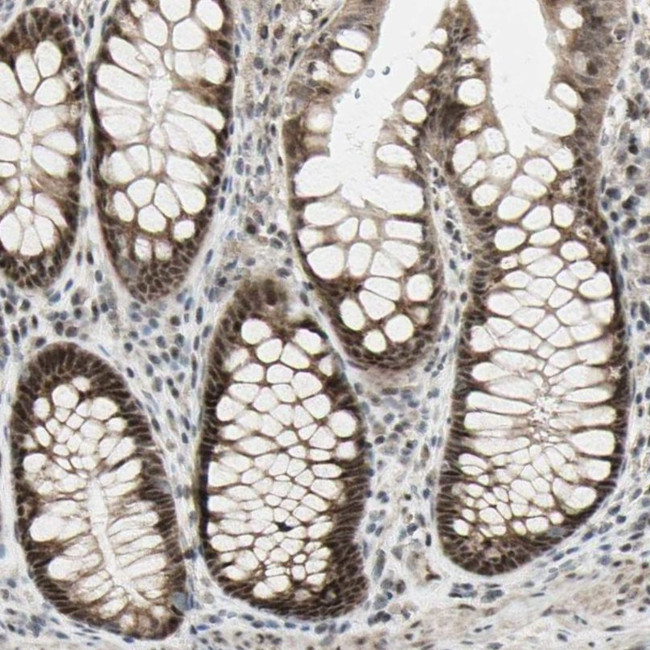 DHRS7B Antibody in Immunohistochemistry (IHC)