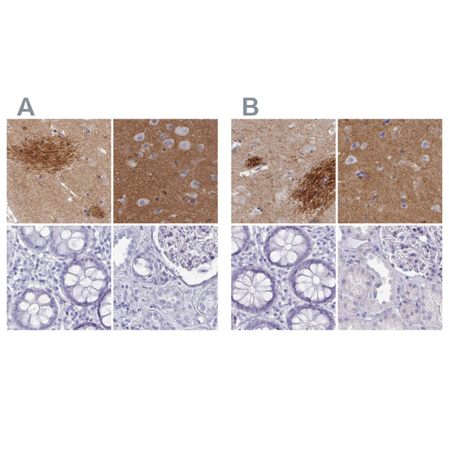 OMG Antibody in Immunohistochemistry (IHC)