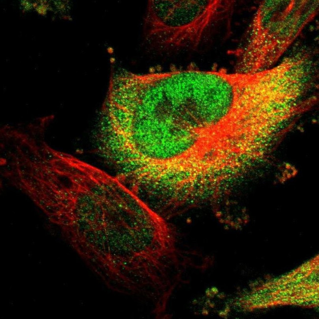 PIGL Antibody in Immunocytochemistry (ICC/IF)