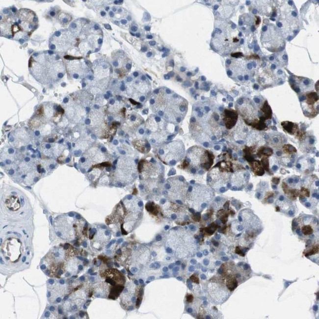 HSPA12B Antibody in Immunohistochemistry (IHC)