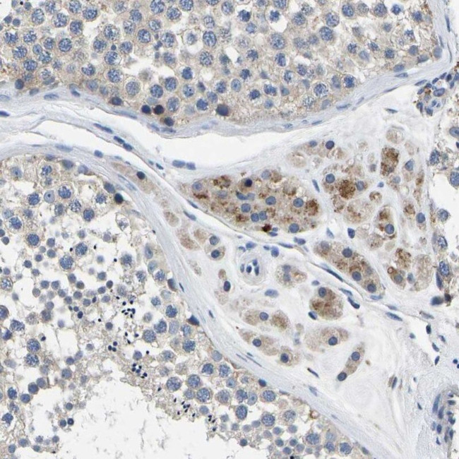 TOR1B Antibody in Immunohistochemistry (IHC)