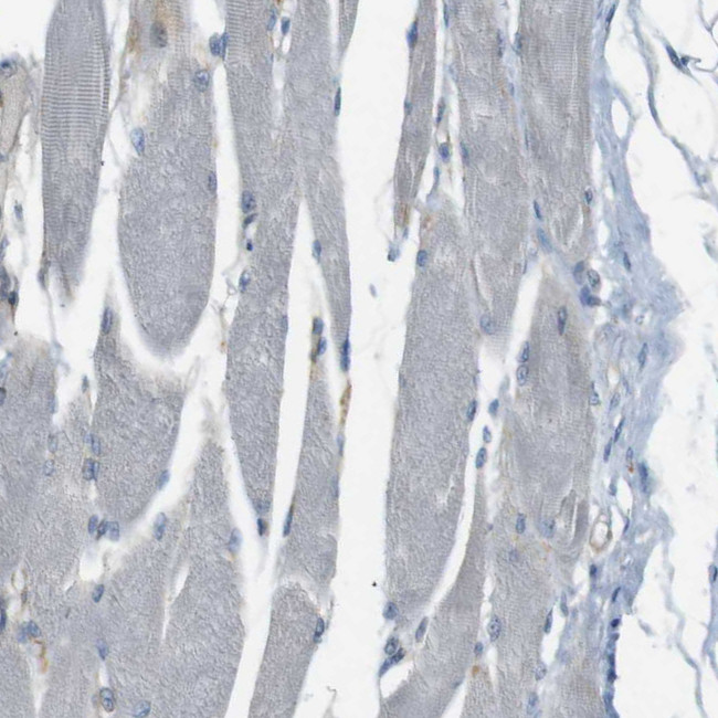 UGT8 Antibody in Immunohistochemistry (IHC)