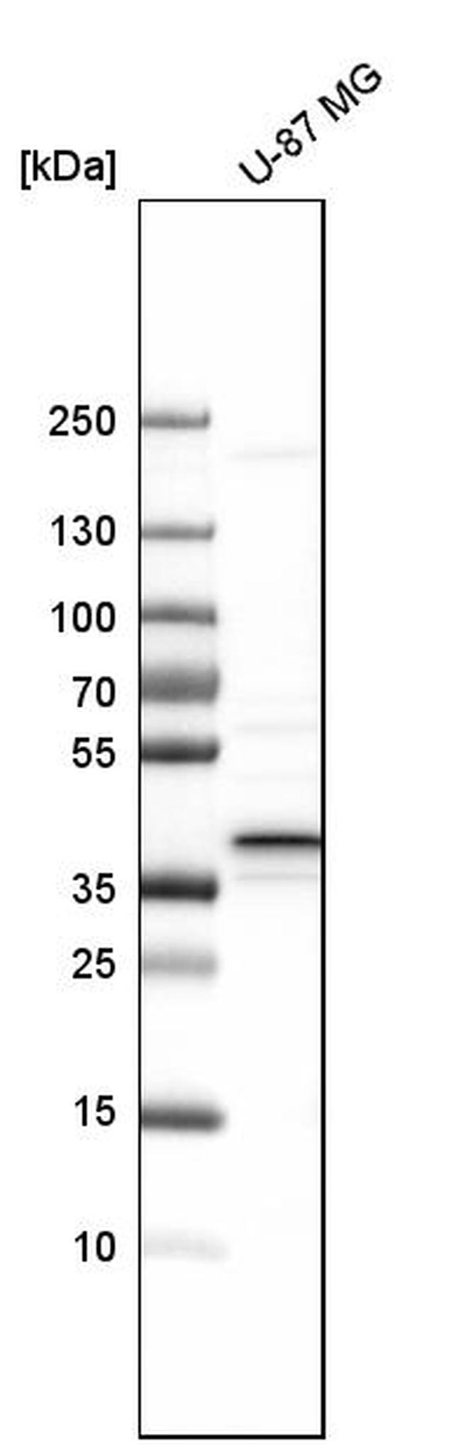 CALHM2 Antibody in Western Blot (WB)