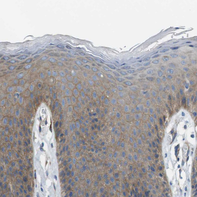 EMP2 Antibody in Immunohistochemistry (IHC)