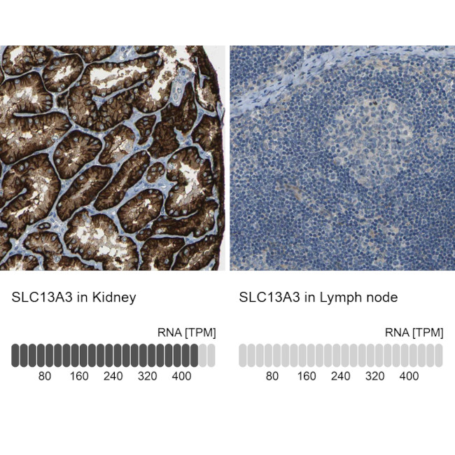 SLC13A3 Antibody in Immunohistochemistry (IHC)