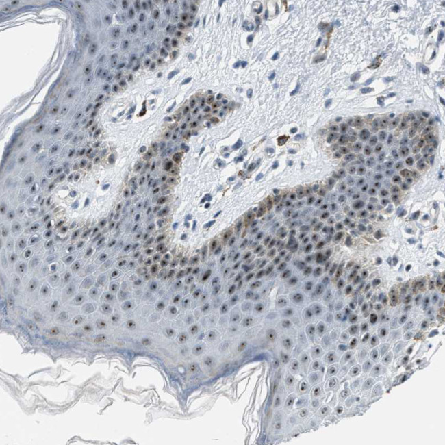 DDX47 Antibody in Immunohistochemistry (Paraffin) (IHC (P))