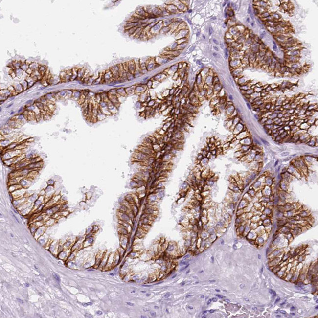 Aquaporin 3 Antibody in Immunohistochemistry (IHC)