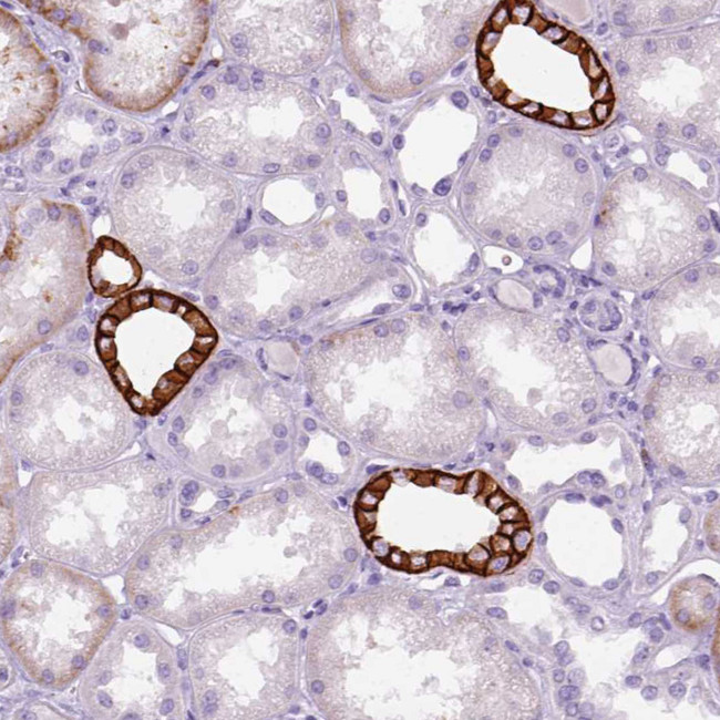 Aquaporin 3 Antibody in Immunohistochemistry (IHC)