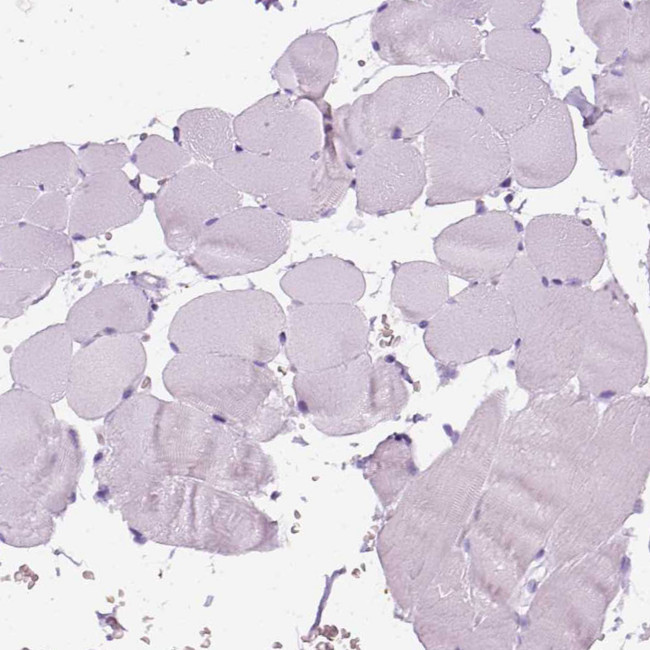 Aquaporin 3 Antibody in Immunohistochemistry (IHC)