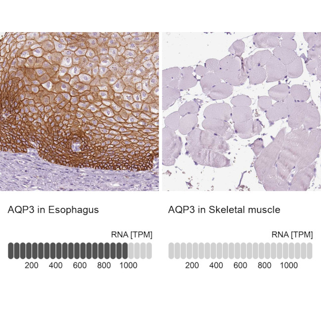 Aquaporin 3 Antibody