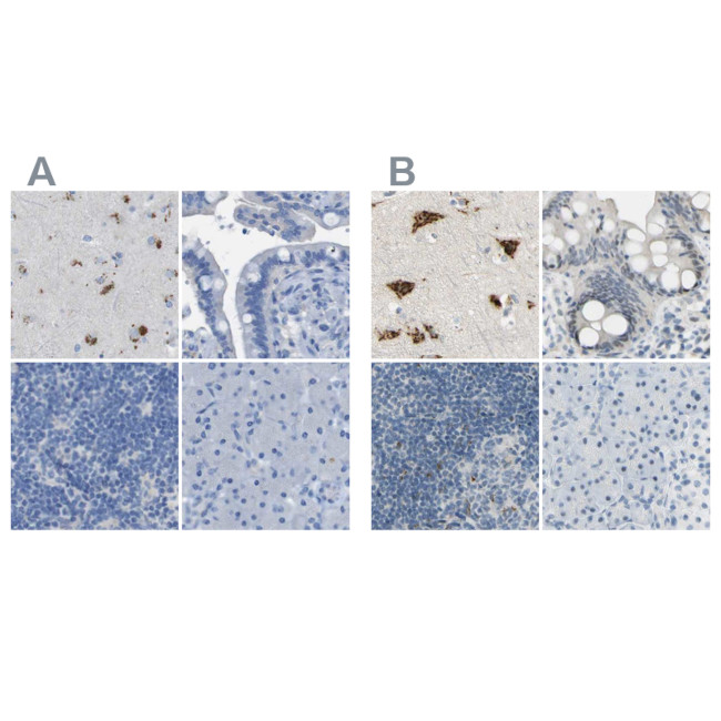 B4GALNT1 Antibody in Immunohistochemistry (IHC)