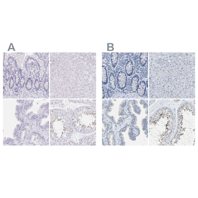 EQTN Antibody in Immunohistochemistry (IHC)