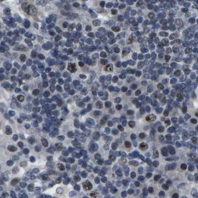 NSRP1 Antibody in Immunohistochemistry (IHC)